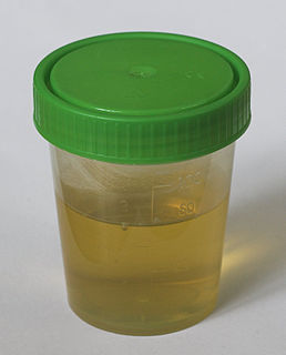 L’urine est l'un des liquides biologiques produits par les animaux, incluant les humains. Elle constitue la plus grande part des déchets liquides du métabolisme de l'organisme des vertébrés.