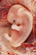 Embrión humano de nueve semanas