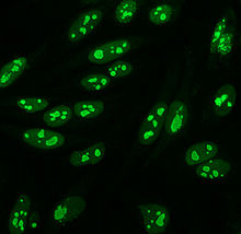 nucleolar pattern antibody nuclear anti staining wikipedia ana anas