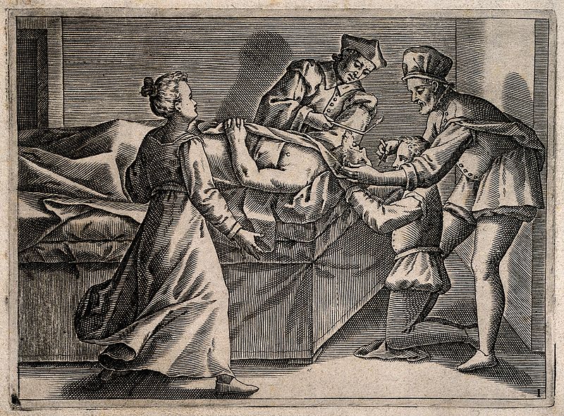File:A surgeon bleeding a man's head, he is aided by two assistan Wellcome V0016793.jpg