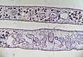 Fasciola hepatica (Körpermitte, quer, Teilausschnitt).jpg