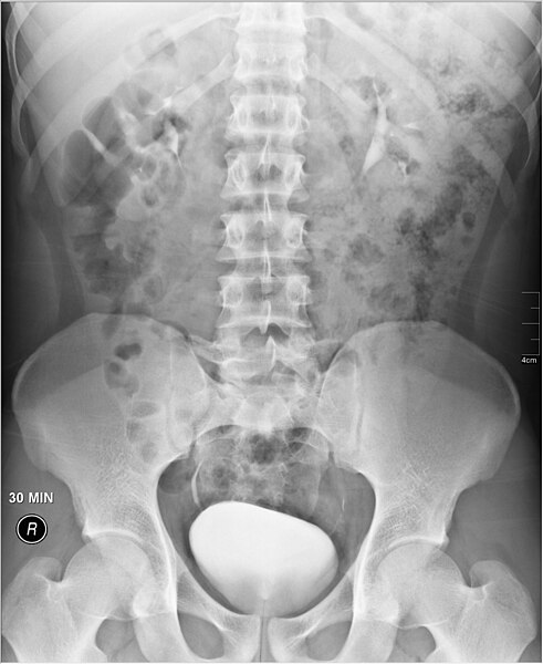 File:Medical X-Ray imaging CTK03 nevit.jpg