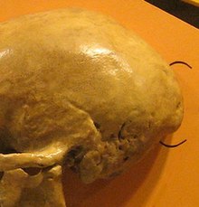 The occipital bun on a Neanderthal skull OccipitalBun.jpg