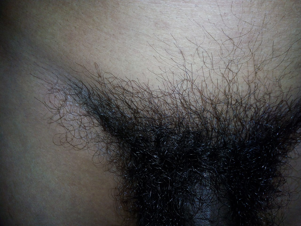 File:Pubic hair genital.jpg - Wikimedia Commons