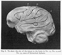 Sir H. Head, Model of the brain, 1926 Wellcome L0015601.jpg