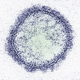 Schmallenbergvirus