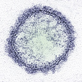 <i>Schmallenberg orthobunyavirus</i> Species of virus