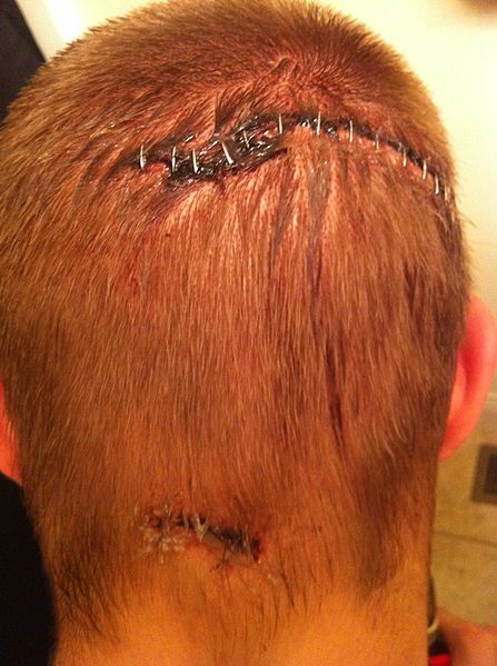 File:19 Staples.jpg