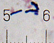 Some of the Bifidobacterium animalis bacteria found in a sample of Activia yogurt:  The numbered ticks on the scale are 10 micrometres apart. 20101210 013757 BifidobacteriumAnimalis.jpg