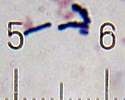 Some of the Bifidobacterium animalis bacteria found in a sample of Activia yogurt:  The numbered ticks on the scale are 10 micrometres apart.