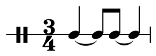 <span class="mw-page-title-main">Canter rhythm</span>