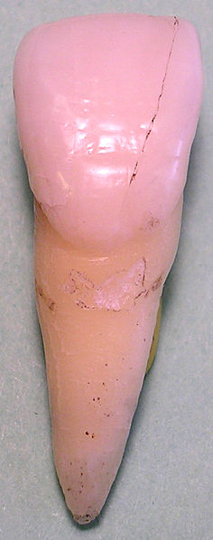 File:Centralincisorfacial06-06-06.jpg