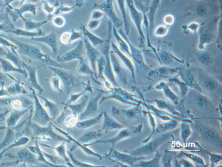Cultured cells growing in growth medium