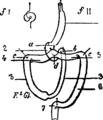 Fig. 84. — Schéma du mode de suspension de i'intestin. I. Le trajet du tube digestif, représenté par deux points d'interrogation. II. Le tube digestif décrit 6 anses : 1, anse gastrique; 2, anse duodé­nale; 3, anse iléo-colique; 4, anse costa sous-pylorique; 5, anse sous pylori-coslale ; G, anse côlo-sigmoïdale. — Il y a six angles de soutènement : a, gastro-duodénal; b, duodéno-jejunal; c, sous­costal droit; d, sous-pilorique ; e, sous-costal gauche; f, sigmoïdo­rectal. (F. Glénard, 1885.)