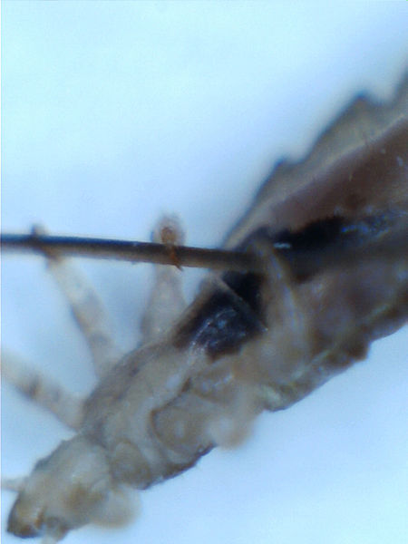 File:Head louse on human hair.jpg