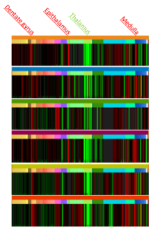 Microarray data from 6 individuals showing the expression of C8orf34 in different regions of the brain. Areas of high expression are shown in red while areas of low expression are noted in green. MicroarrayABA.png