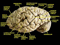 Верхняя височная. Supramarginal gyrus. Superior frontal gyrus. Средняя височная извилина. Нижняя височная извилина.