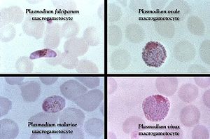 Malaria: Oorsprong van de malaria, De parasiet, De ziekte