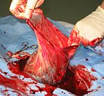 The amniotic sac opened during afterbirth examination
