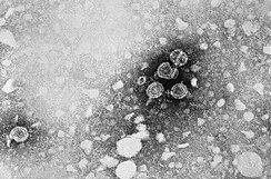 Hepatitis B virus 01.jpg