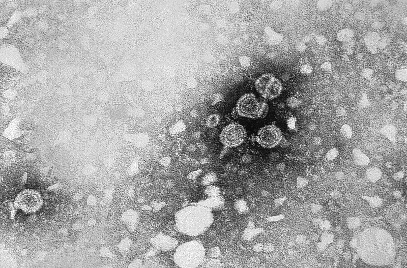 File:Hepatitis B virus 01.jpg