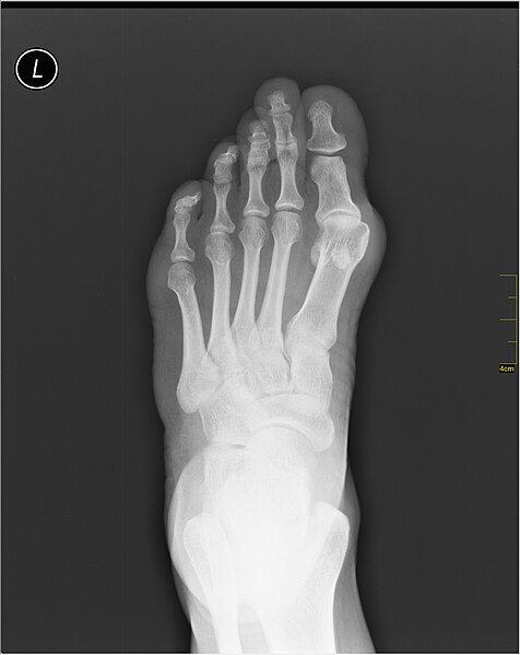 File:Medical X-Ray imaging UCG07 nevit.jpg