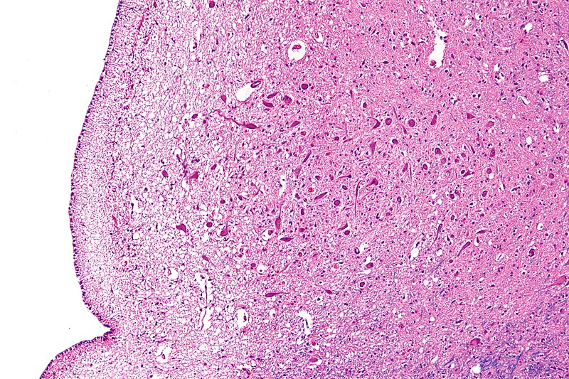 File:Medulla oblongata - posterior - cn x - intermed mag.jpg