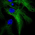 Neural Stem Cells and Growth Hormone Receptor.jpg