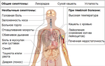 Thumbnail for File:Symptoms of coronavirus disease 2019 2.0-ru.png