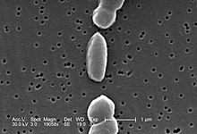 Vibrio parahaemolyticus 01.jpg 