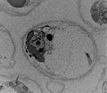 File:4Calcidiscus leptoporus, haploid, haptonema in lower left, TEM.tif