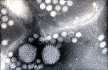 Two adenovirus particles surrounded by numerous, smaller adeno-associated viruses (negative-staining electron microscopy, magnification approximately 200,000x) AAVs by electron microscopy.jpg