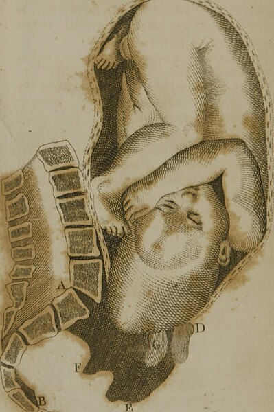 File:A set of anatomical tables, with explanations, and an abridgment of the practice of midwifery - with a view to illustrate a treatise on that subject, and collection of cases (1793) (14783897172).jpg