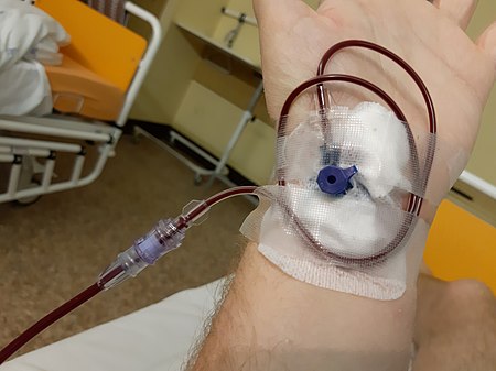 Tập_tin:Blood_transfusion_B.jpg