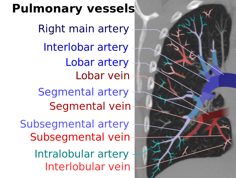 File:Computed tomograph of pulmonary vessels (vector).svg