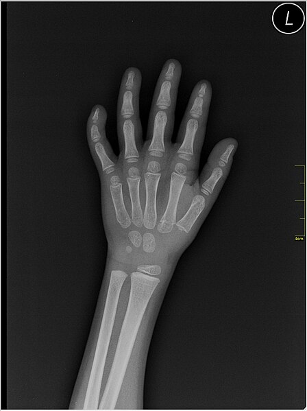 File:Medical X-Ray imaging OMW06 nevit.jpg