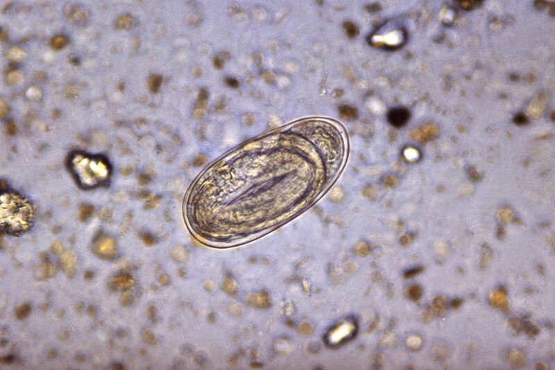 File:Necator americanus, Ancylostoma duodenale egg.jpg