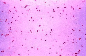 Neisseria gonorrhoeae (Ordnung Neisseriales), Färbung nach Gram, Lichtmikroskopie