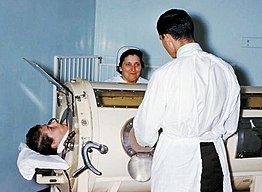 Hospital staff examine a patient in an Iron lung tank respirator during the polio epidemic. The machine creates a negative pressure around the thoracic cavity, thereby causing air to rush into the lungs to equalize intrapulmonary pressure. Poumon artificiel.jpg