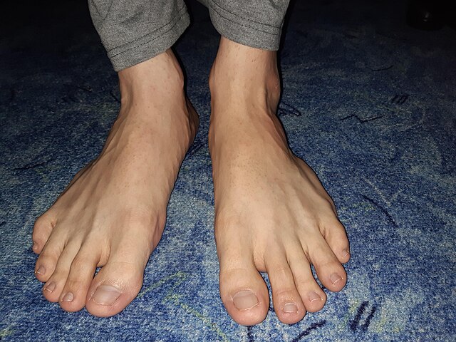 Sole (foot) - Wikipedia