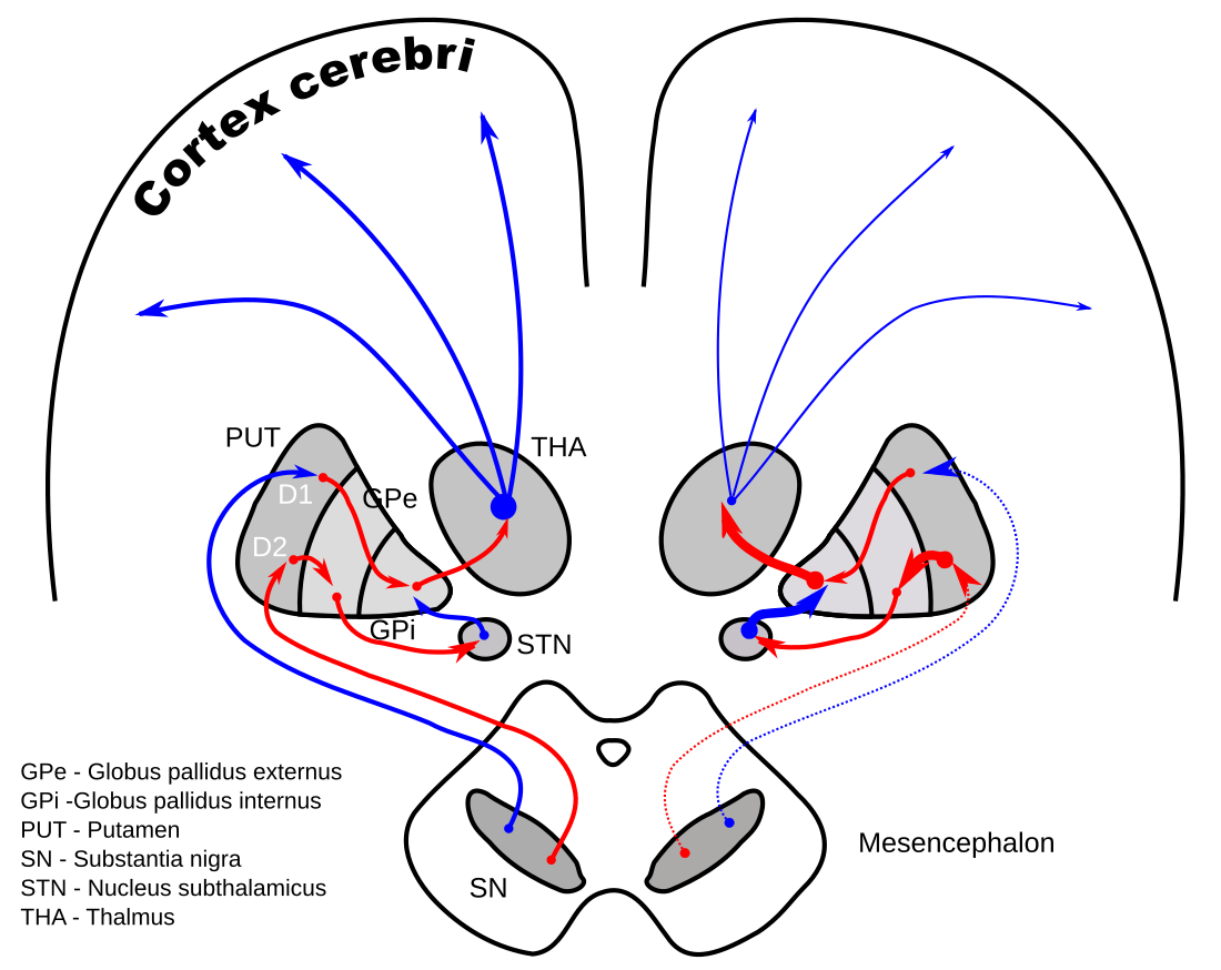 Hemibalismo