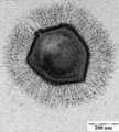Fotografia d'un virüs gigant dau genre Mimivirus.