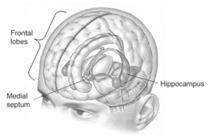 Most of Molaison's hippocampus was removed bilaterally. Hippolobes.gif