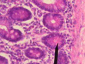 Human Paneth cells.JPG
