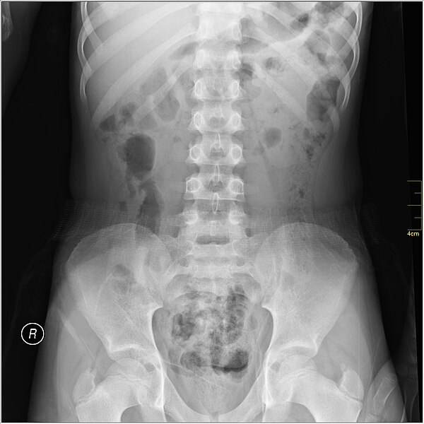 File:Medical X-Ray imaging WUW07 nevit.jpg