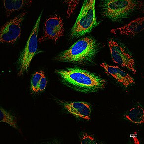 Multi-color fluorescence imaging of living HeLa cells with labelled mitochondria (red), actin (green), and nuclei (bue). Each cell is ~10 um and images show optical imaging allows for resolution <=1 um. Multicolor fluorescence image of living HeLa cells.jpg