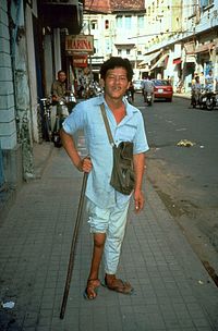 Чоловік з атрофованою правою нижньою кінцівкою внаслідок перенесеного поліомієліту.