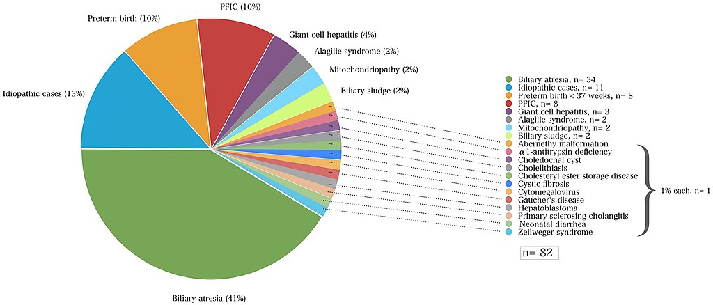 Preterm birth - Wikipedia