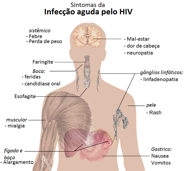 File:Sintomas da infecção aguda pelo HIV.png