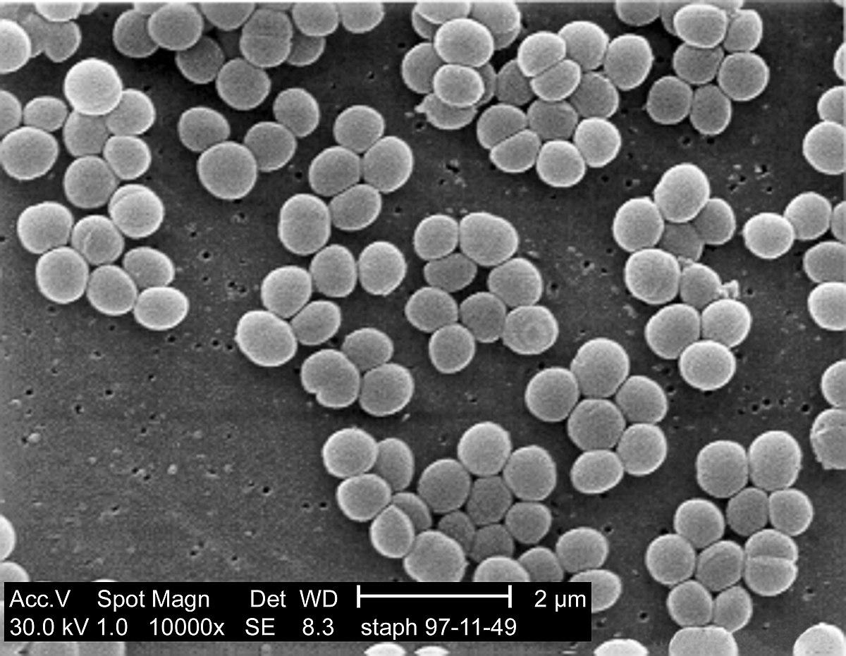 Staphylococcus - Wikipedia